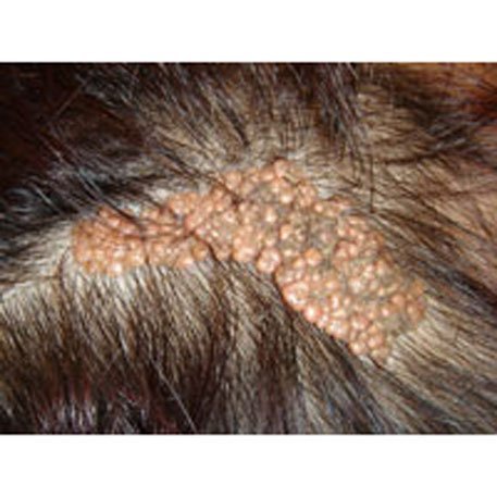 Smismatogonos