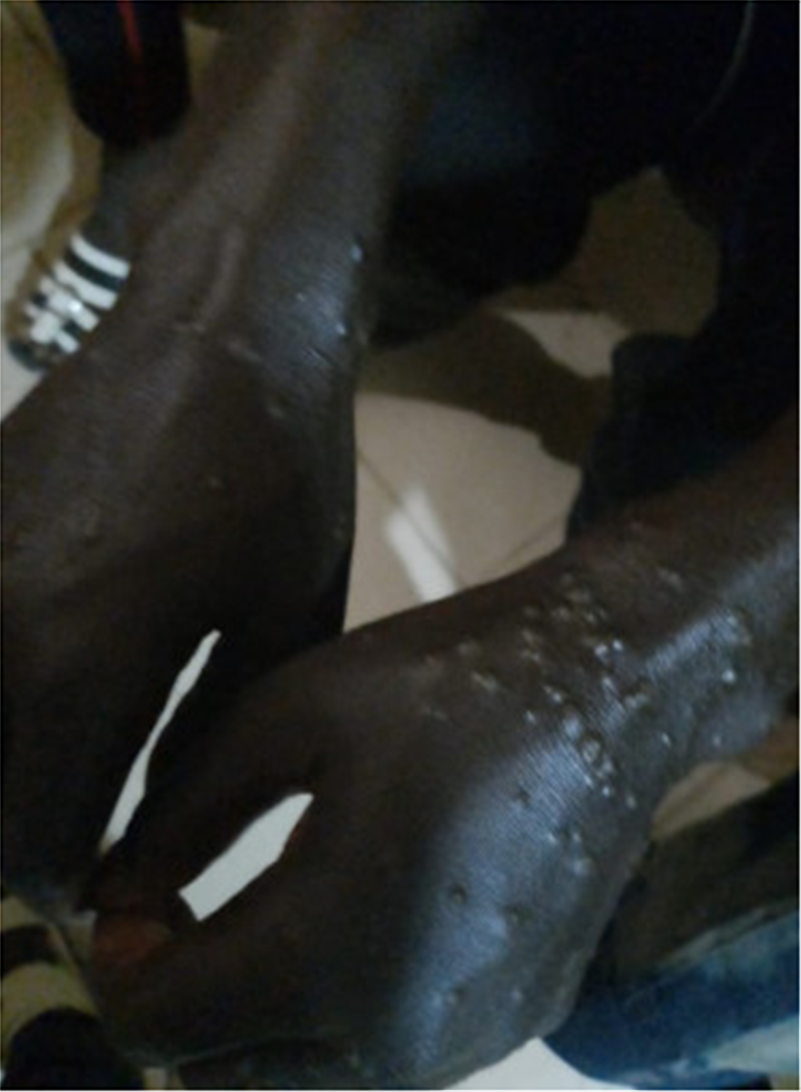 senegali 