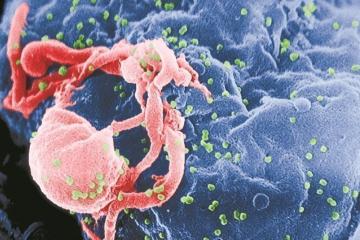 Ακόμα ένας ασθενής που θεραπεύτηκε από AIDS