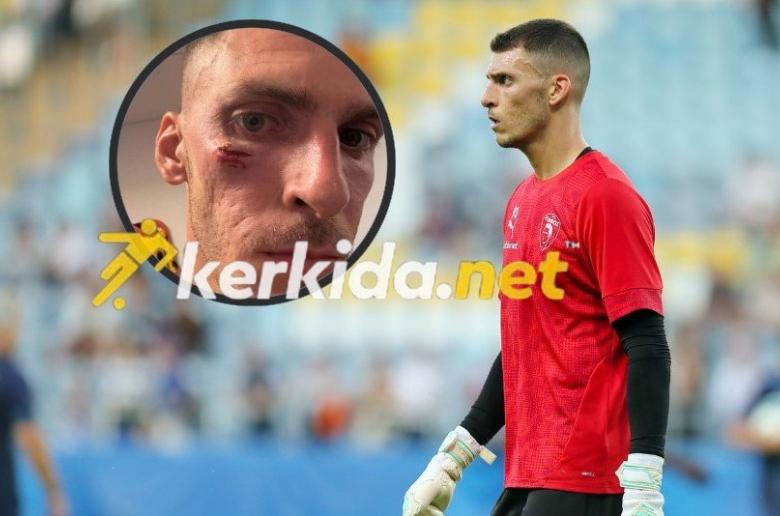 Το... σουβενίρ του Νεόφυτου - Σε κλινική για ραφές (Φώτο Kerkida)